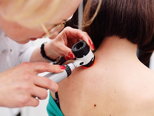 Предраковые заболевания: предупреждение или повод для паники?