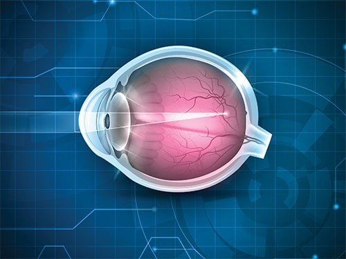 Человечеству грозит эпидемия миопии